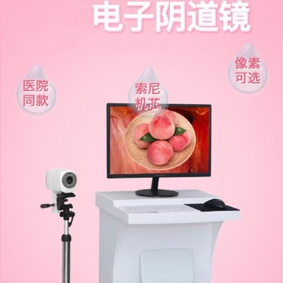 数码电子阴道镜生产厂家 宫颈镜检查镜 医用妇科私密检查设备/一