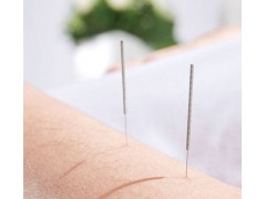 中医针灸有几种方法